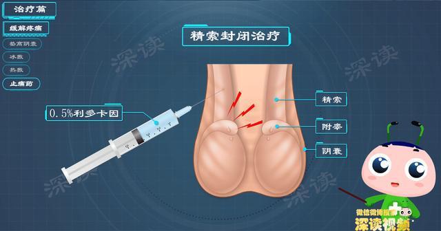蛋疼肿胀该咋办细数附睾炎治疗那些坑小心毁于一蛋