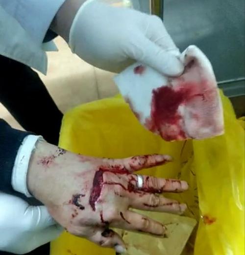 事发凯里!昨天凌晨流浪狗窜入值勤点咬伤工作人员