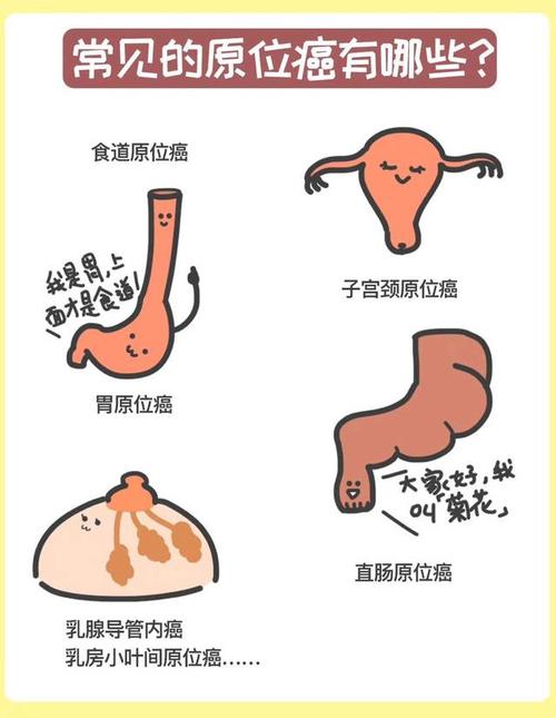 一张图看懂「原位癌」是个啥?