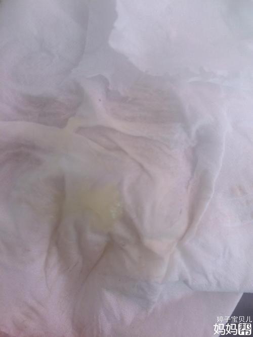 姐妹们帮忙看看咋回事.