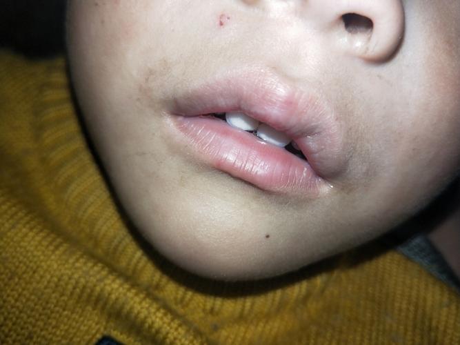 男宝宝31个月了最近发现长唇毛了有没有事啊