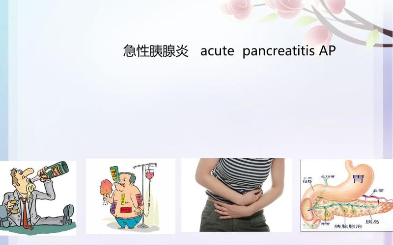 内科学:急性胰腺炎 (3).ppt 55页