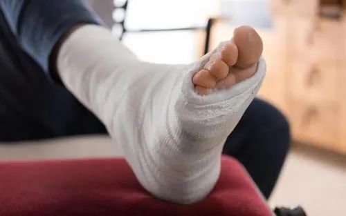 这些坑娃的事,你可能做过|坑娃|骨折|石膏|固定|手术|车祸|-健康界