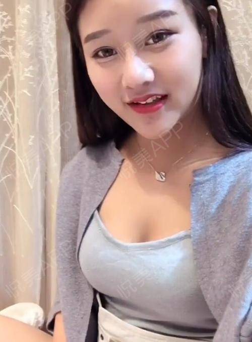 自体脂肪隆胸术后15天_隆胸术后15天_胸部术后15天_装着快乐给你看""