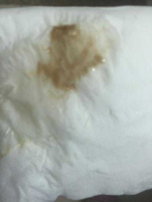 我是女生,今年25,跟男友房事后,第一次,今天下身流出褐色液体,第一天