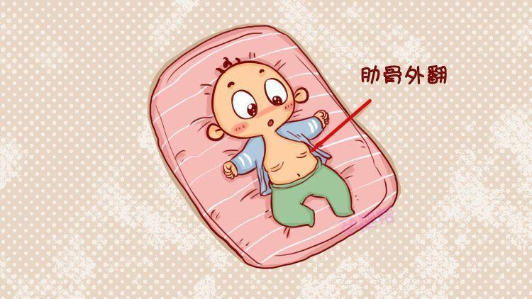 宝宝肋骨轻微外翻,是因为缺钙吗?