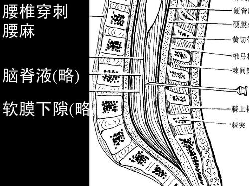 腰椎穿刺 腰麻 脑脊液(略) 软膜下隙(略)