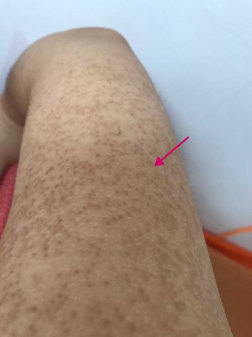 我希望替你承担.