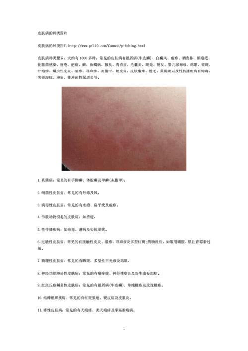 皮肤病的种类图片.pdf 4页