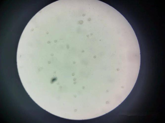 显微镜放大16070的斜管虫显微镜放大6470的水霉因此,今天我们从