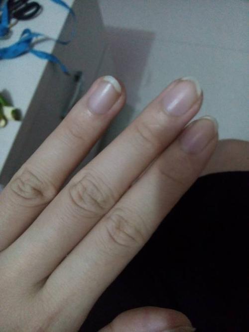 问:为啥指甲有点乌紫乌紫的