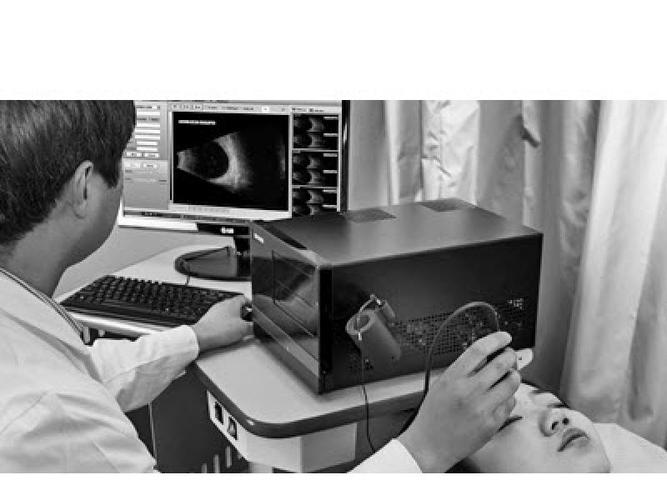 眼科a/b超声诊断仪 sw-2100