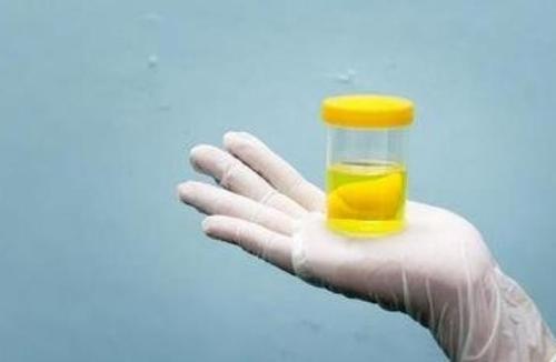 5个降尿蛋白方法,你做到了