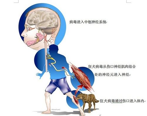 狂犬病病毒具有很强的神经组织亲和性,病毒进入人体以后会从被咬伤