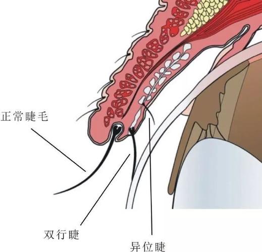  p>双行睫为正睫毛根部后方相当于 a target="_blank" href="/item