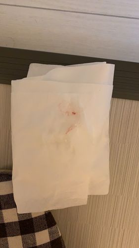 排卵期同房一个礼拜后出血,这个是着床出血吗