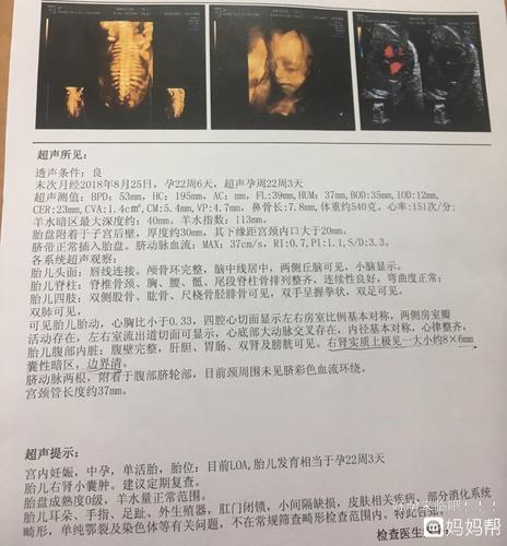 四维数据像女宝?