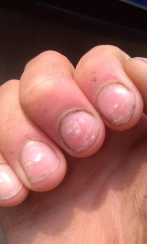 本人干修车 指甲有白点是为啥么求解