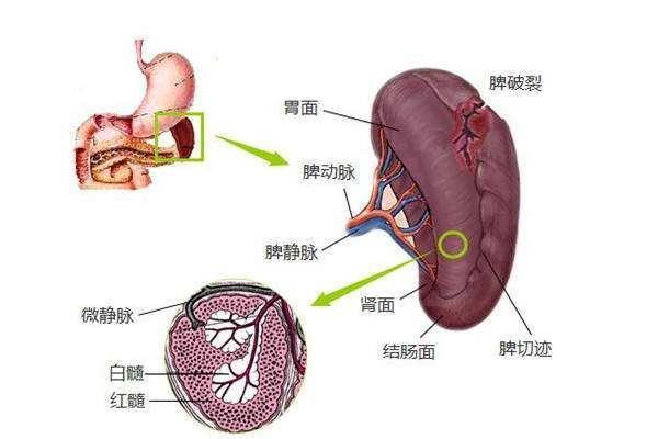 如何预防脾肿大? 医生告诉你5个饮食禁忌