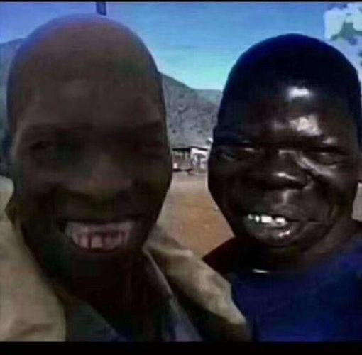 非洲人大概有四种肤色区别你知道吗