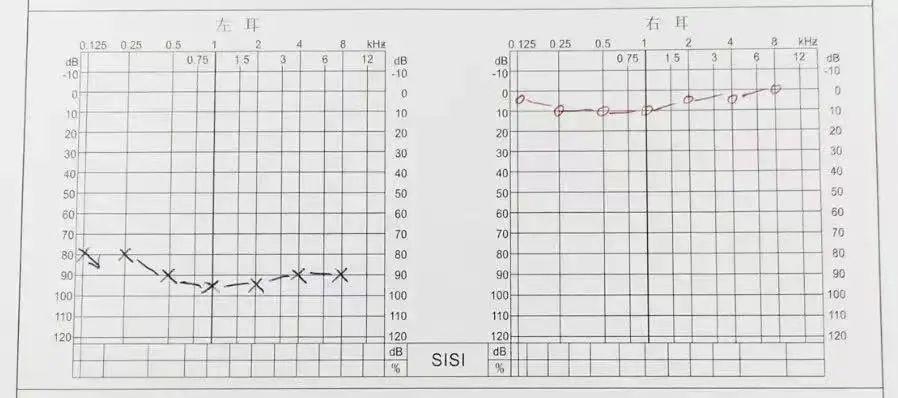 注意,耳机正在慢慢偷走你的听力