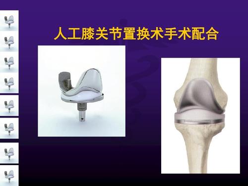 人工膝关节置换术手术配合pptppt课件