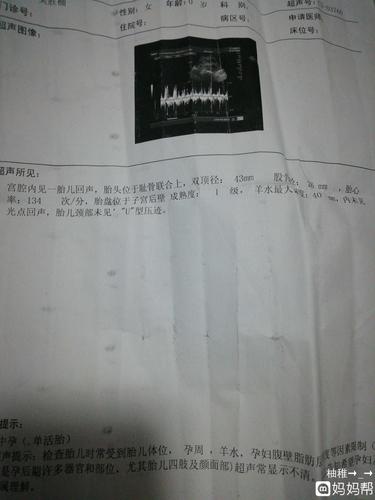 18周整的时候做过一次b超,胎盘成熟度1级