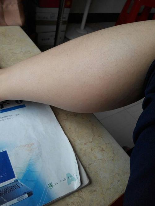 供氧不够,小腿细胞进行无氧呼吸,产生乳酸堆积在小腿哪里吗