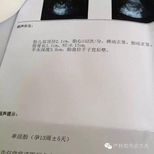 母婴 正文  怀孕了忧喜参半,喜的是怀上了,忧的是不是宫内孕,健不健康