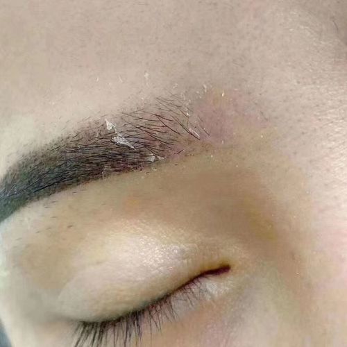 纹眉结痂的厚薄和留色的关系,纹绣师如何控制结痂的厚薄