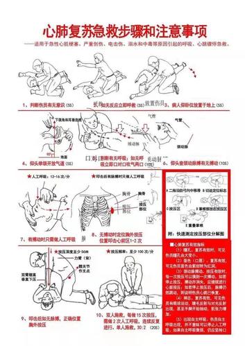 我院心肺复苏公益培训走进长安新能源汽车有限公司