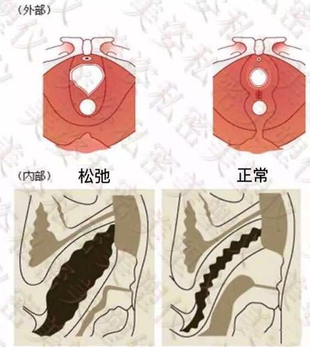 二,阴道松弛的症状与危害此外,阴道松弛有后天也有先天性因素,我们在