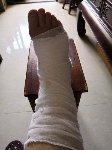 厦大宿舍水电,脚骨折记录,美食,中秋博饼及世纪公园