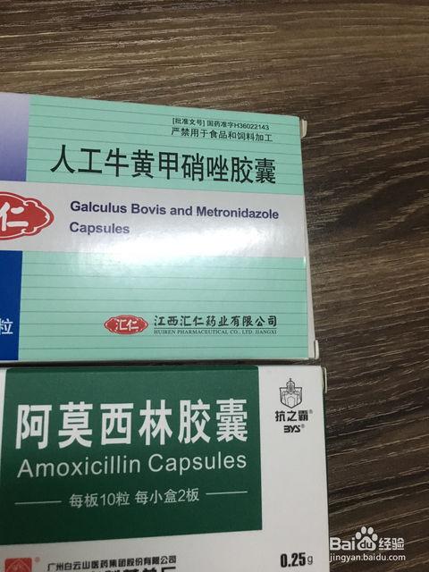 上火引起的牙龈肿痛如何治疗