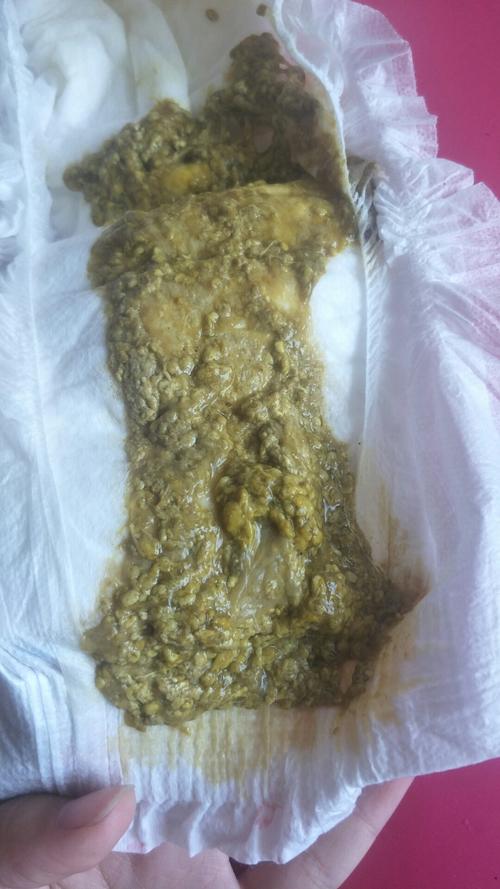 各位宝妈们好,我儿子九个月了这几天老是拉肚子,消化不良,但是