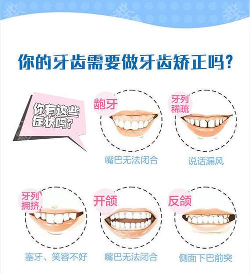【隐形托槽矫正】进口单晶陶瓷托槽矫正
