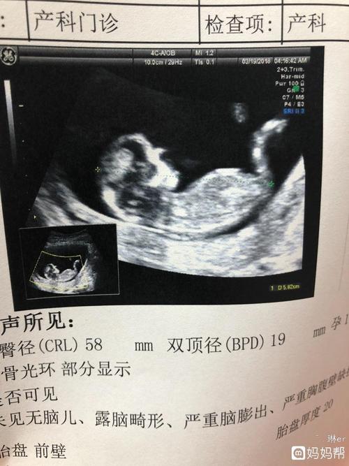 有没有nt图会看男女的姐妹帮忙看看