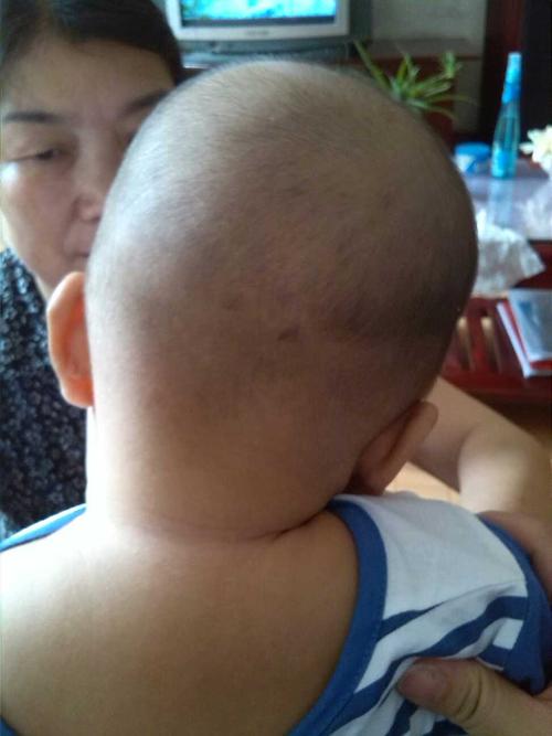 快四个月宝宝头睡偏了,怎么办?