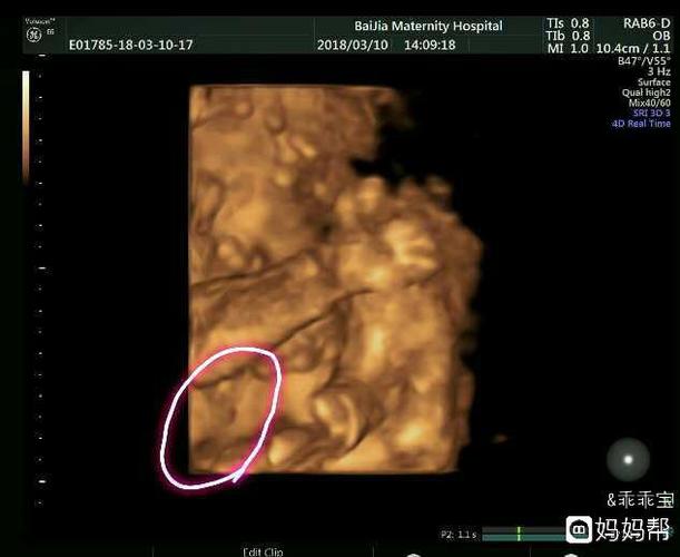 帮看下四维照片这个部位是男宝吗?