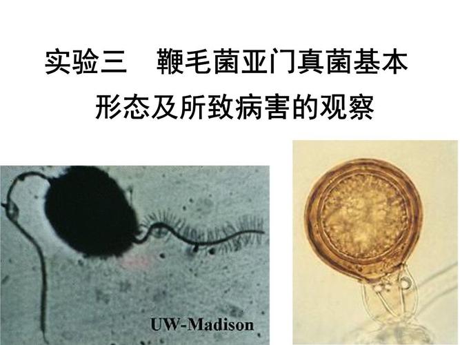 20世纪60年代以来,因本亚门真菌无性生殖产生能动的游动孢子,有性