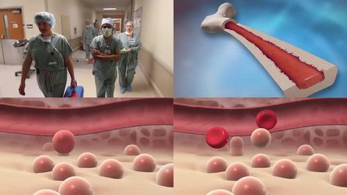 骨髓移植视频素材