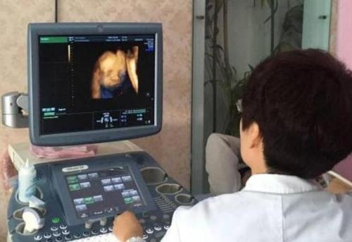 怀孕期间,做四维彩超时,为什么胎儿经常会捂着脸?