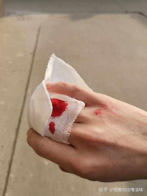 在没有保护的情况下用拳头砸玻璃会伤到手吗