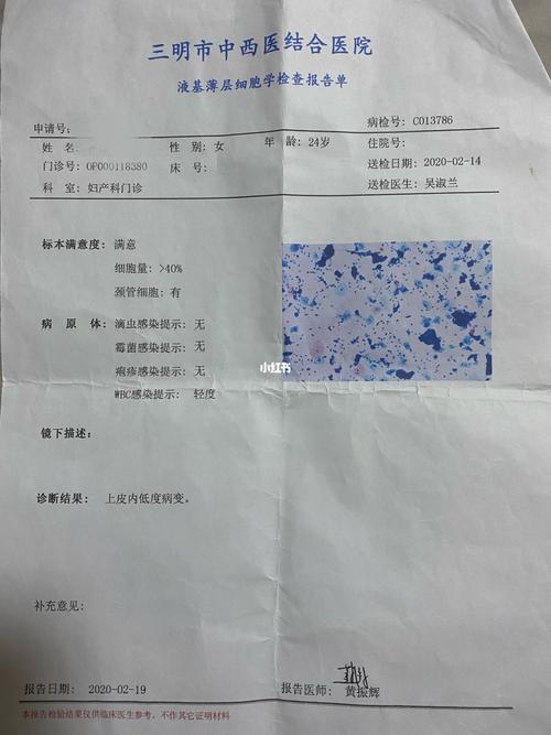 hpv和tct检查报告 宫颈癌患者_hpv_宫颈癌_日记_抗癌