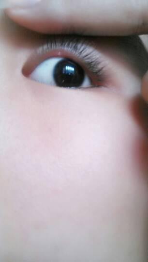 求大神看看,眼睛里边怎么长了个小白泡,好磨眼啊