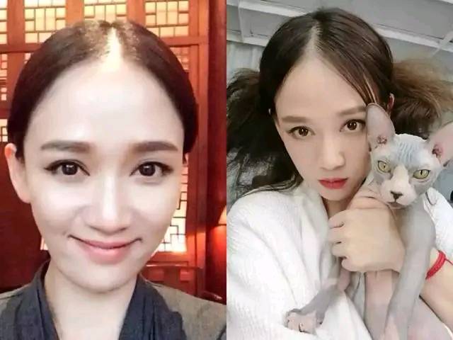 女明星发际线后移,杨幂不算什么,更严重的是郑爽头发已明显减少