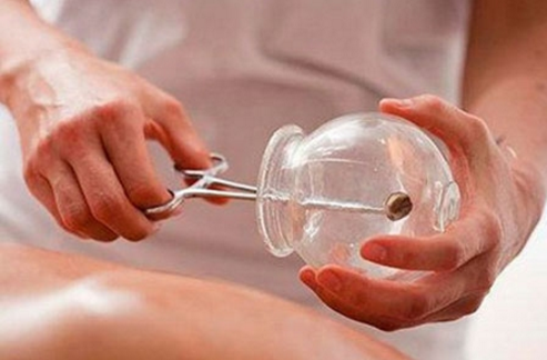 拔罐可以治疗痛经吗 痛经拔罐的位置图