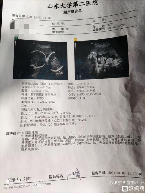 双胎单绒双羊