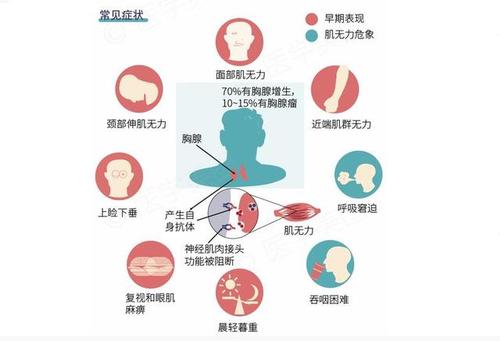 北京崇文门痿症科殷世荣重症肌无力患者如何正确饮食