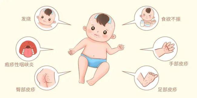 东光县幼儿园秋季手足口病温馨提示